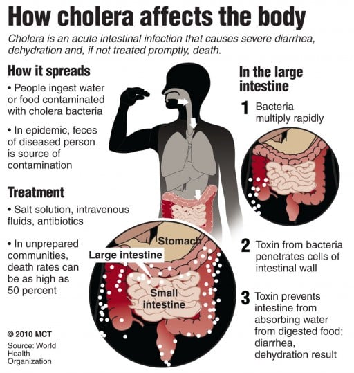 Cholera Kills On Oregon Campus
