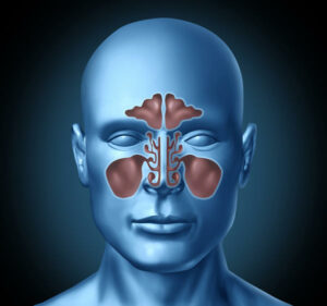 sinusitis and viral meningitis